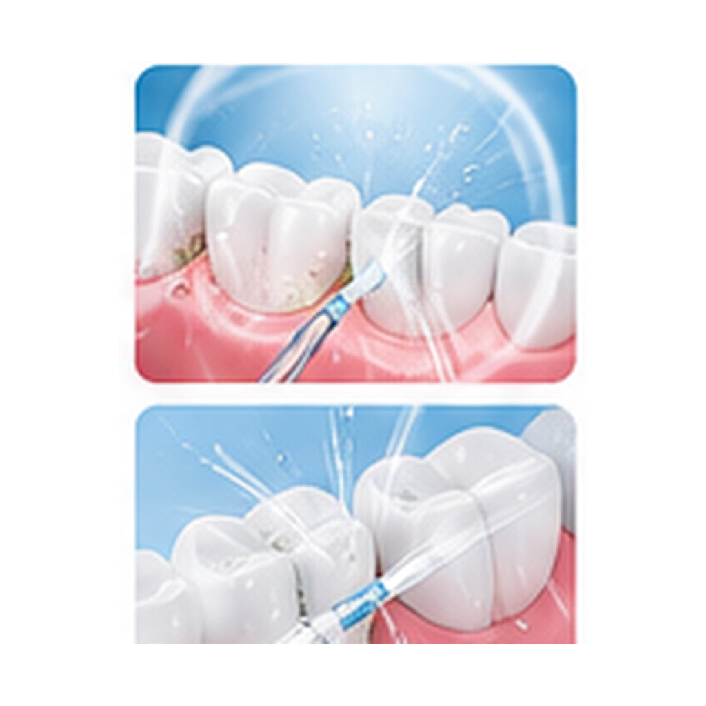 Illustrative AI concept of Oral Irrigator; 3 of 4. Exact supplier item and specifications not verified